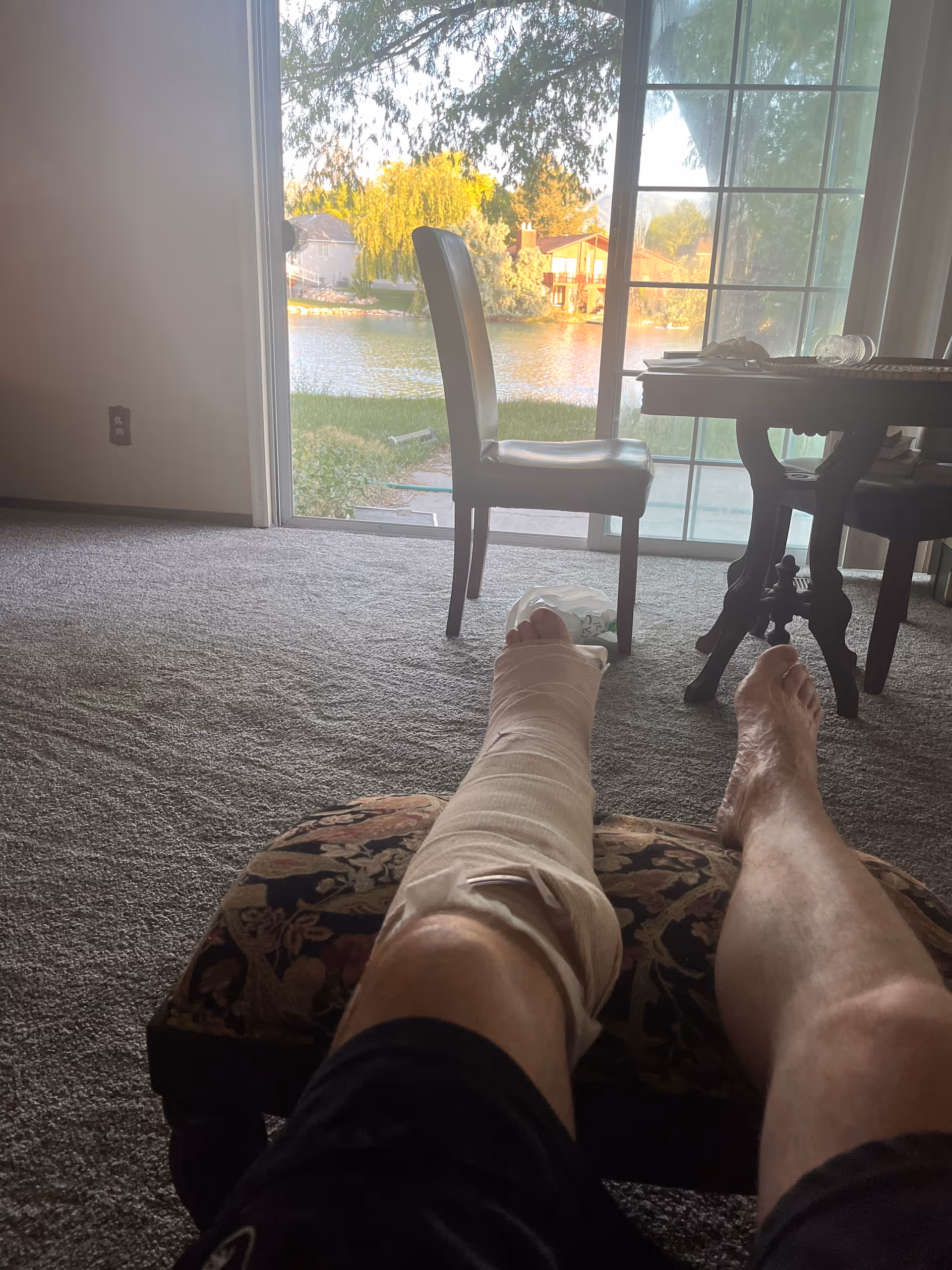 Leg in a cast rests on an ottoman in a living room, overlooking a lake.
