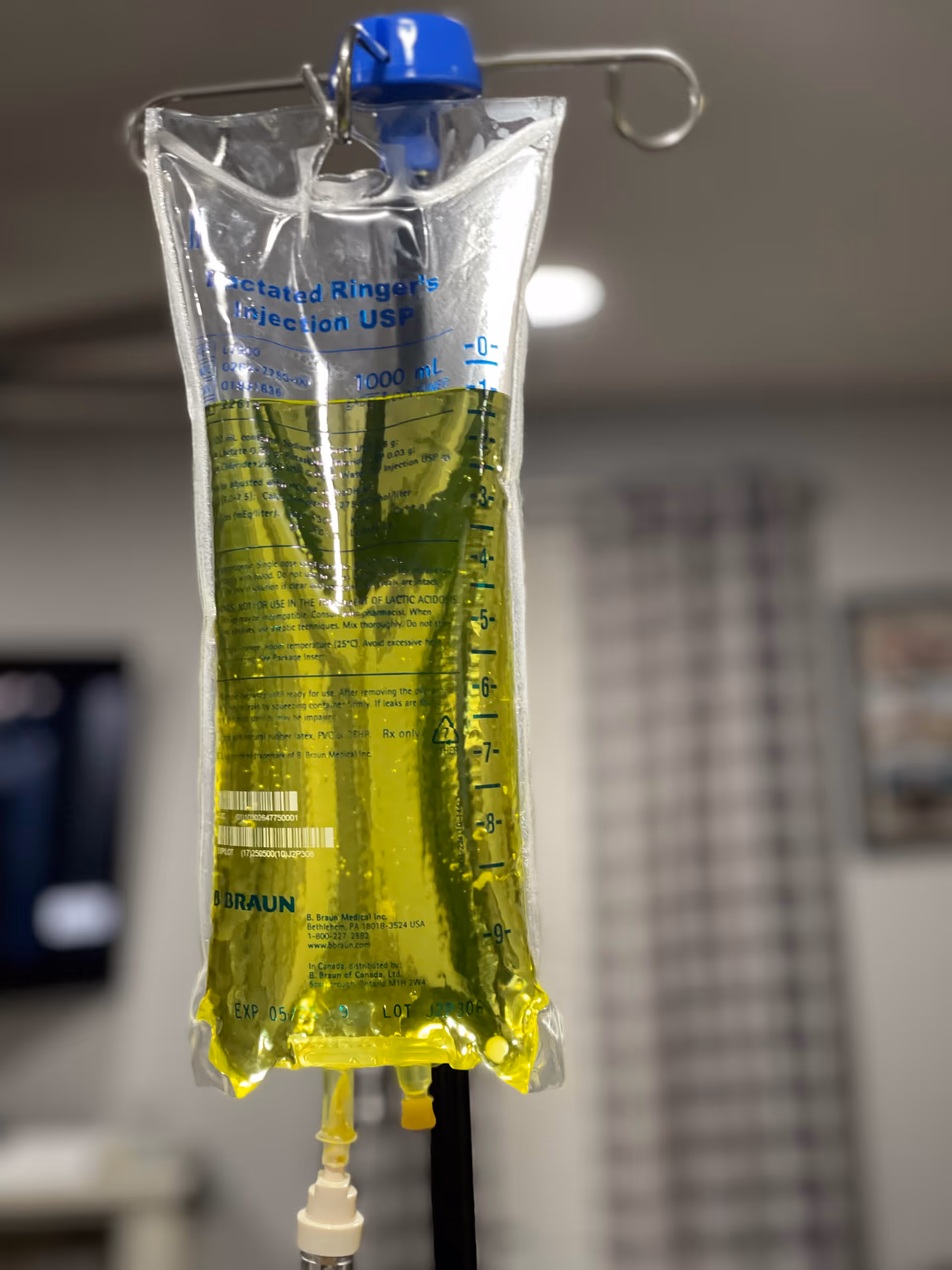 An IV drip bag with yellow liquid in a medical facility.