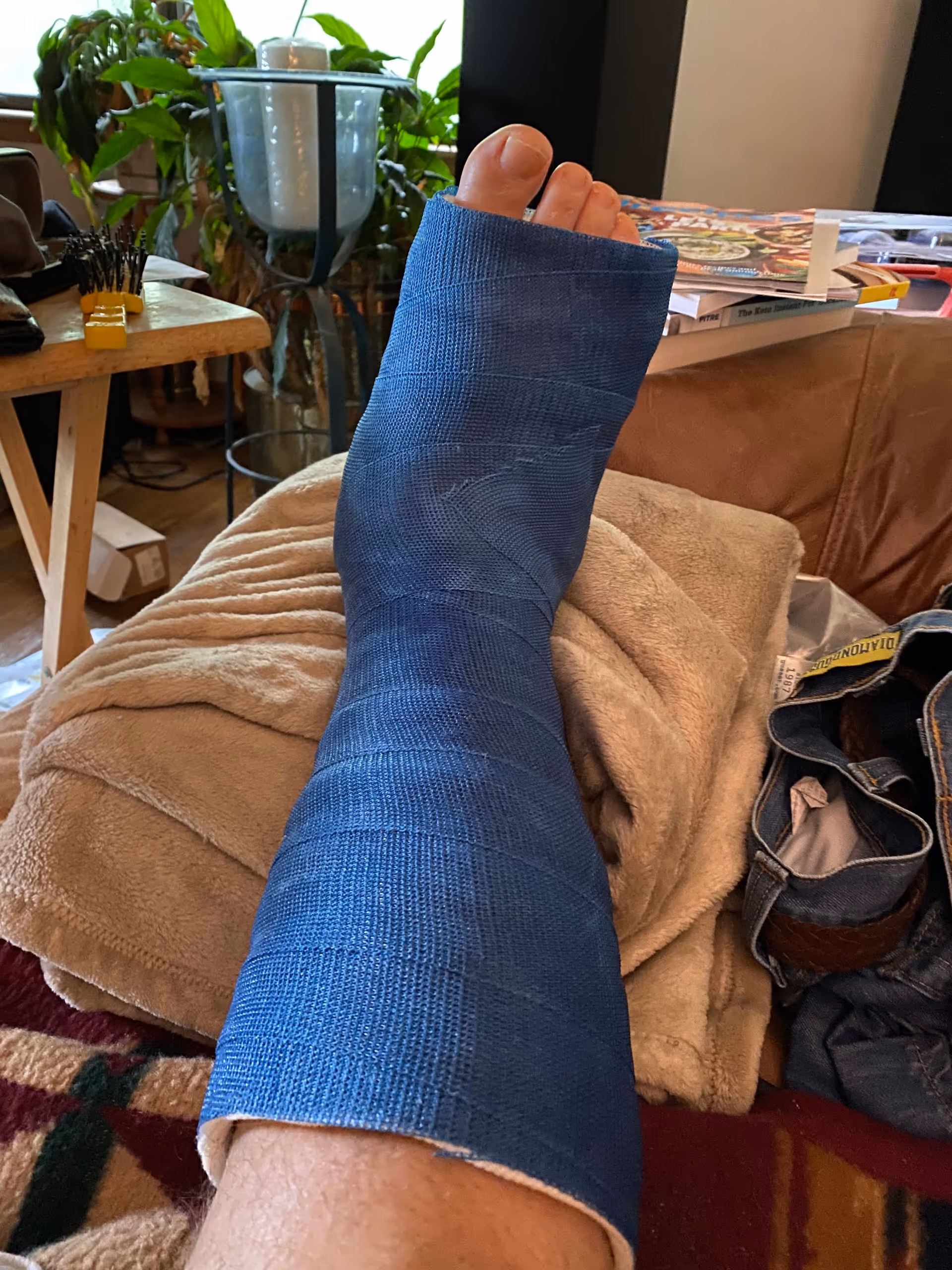 Blue leg cast resting on a beige blanket in a living room.