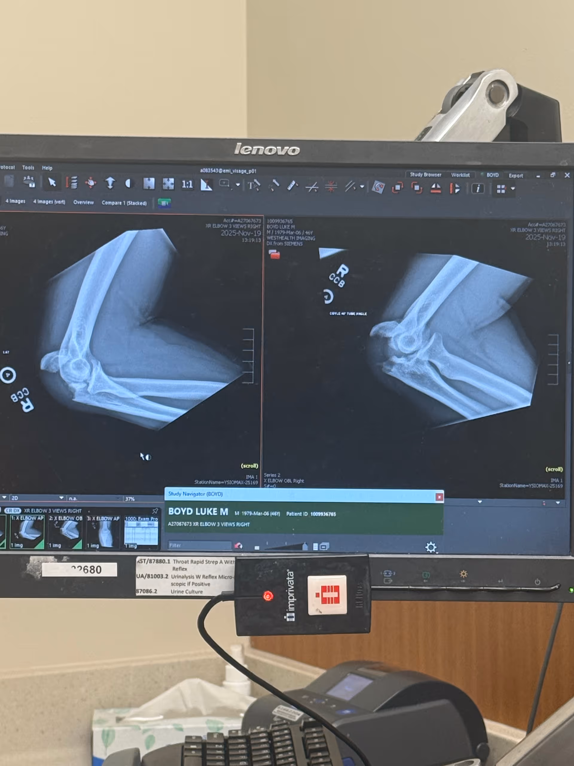 X-ray images displayed on dual monitors in a clinical imaging room.