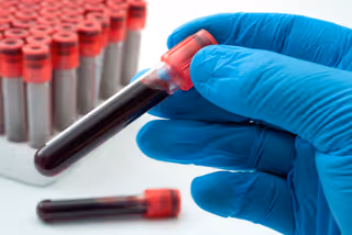 Blue-gloved hands hold a blood sample tube beside a rack of tubes.