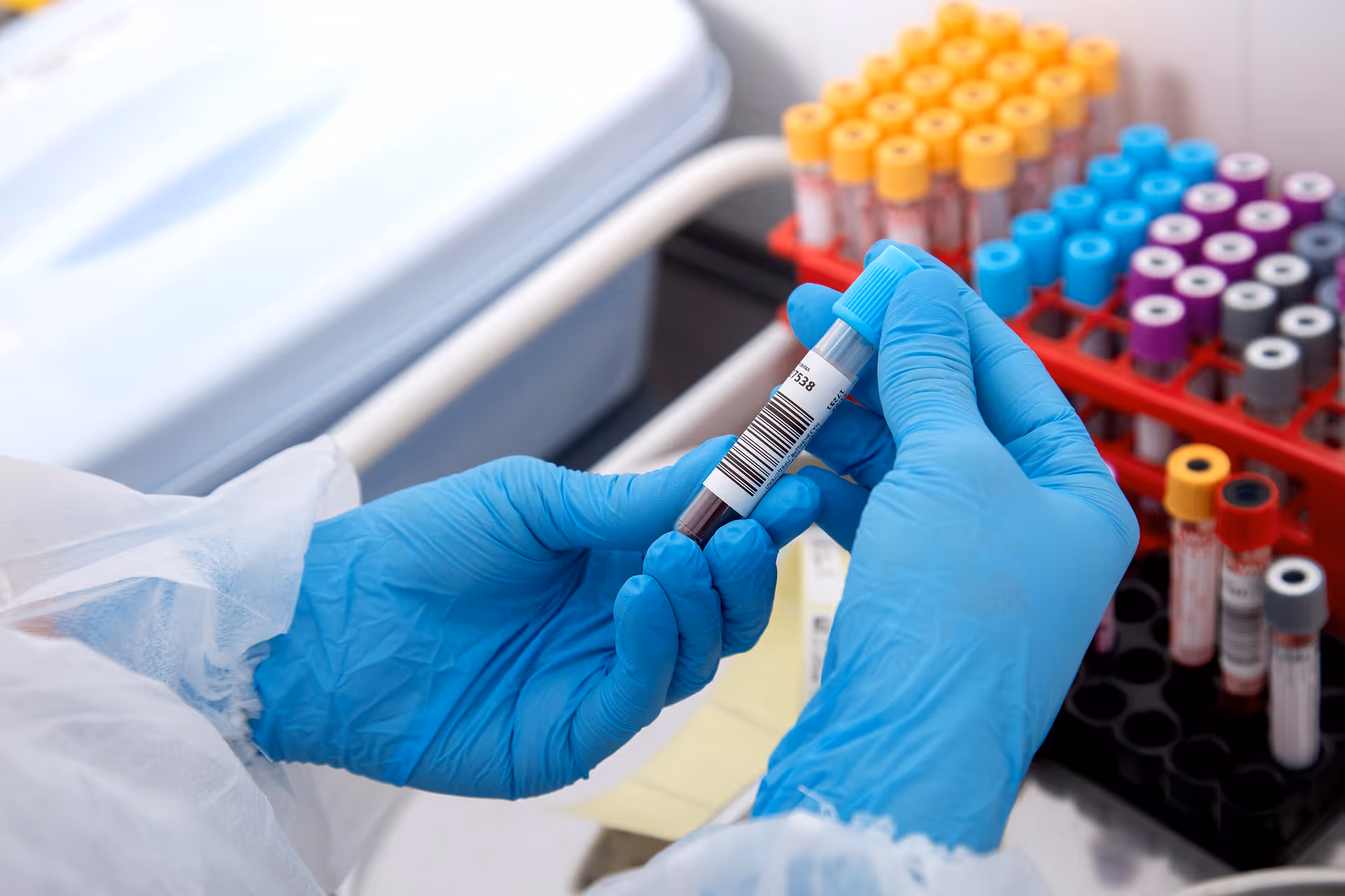 Blue-gloved hands hold a blood sample vial with barcode in a lab setting.