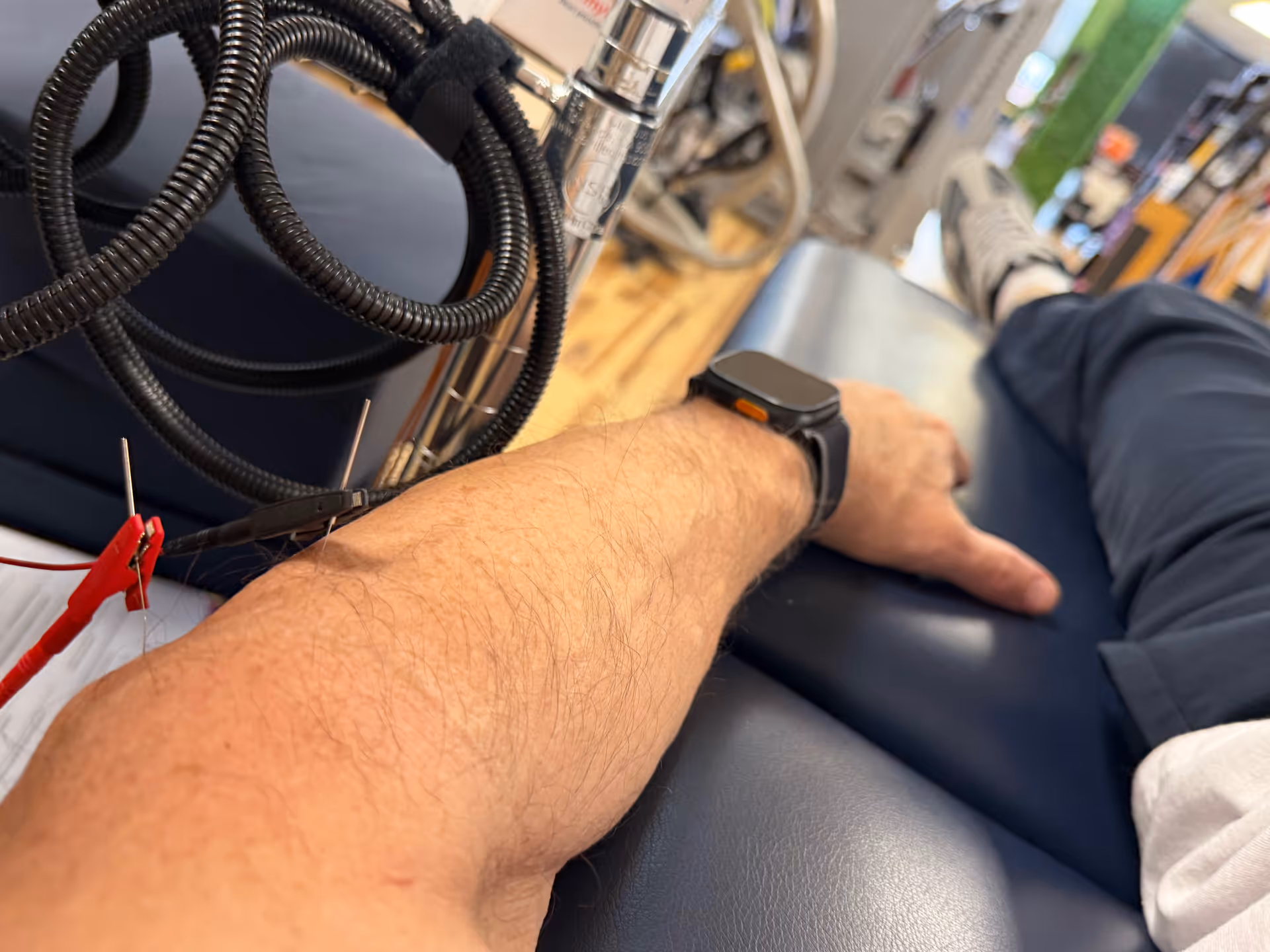 Close-up of a forearm with medical cables and a smartwatch in a clinical setting.