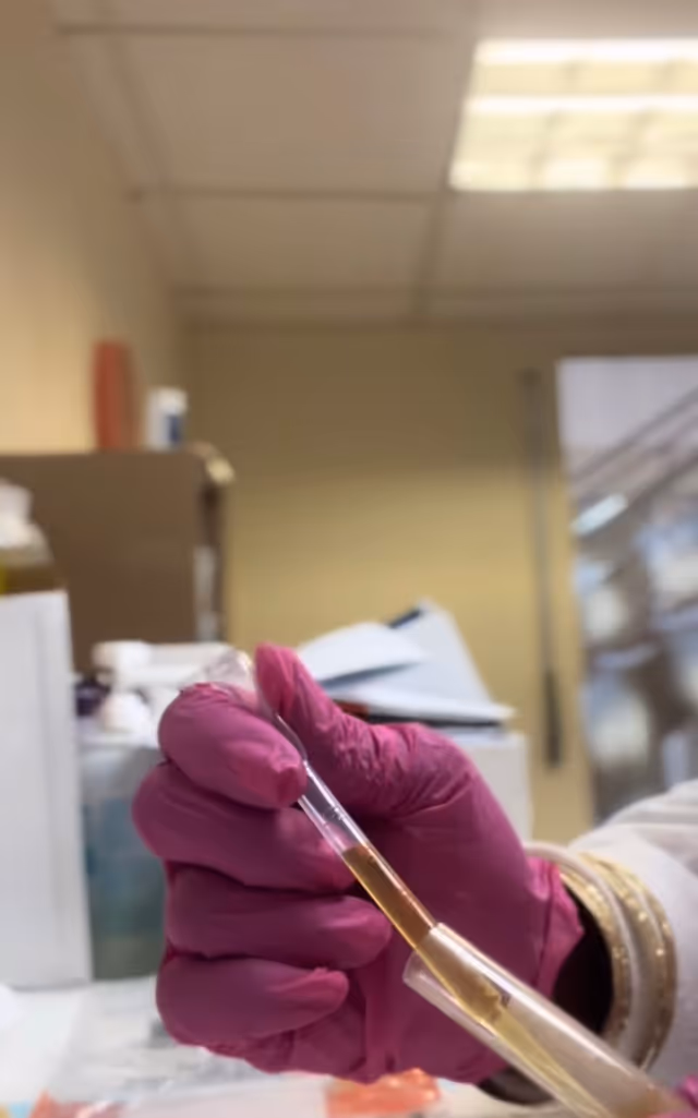 Gloved hand holds a pipette with blood in a clinic laboratory.
