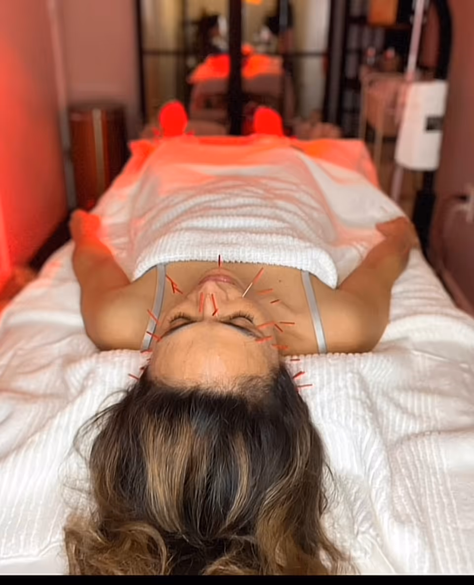 Patient lying on a treatment bed with acupuncture needles in neck area indoors.