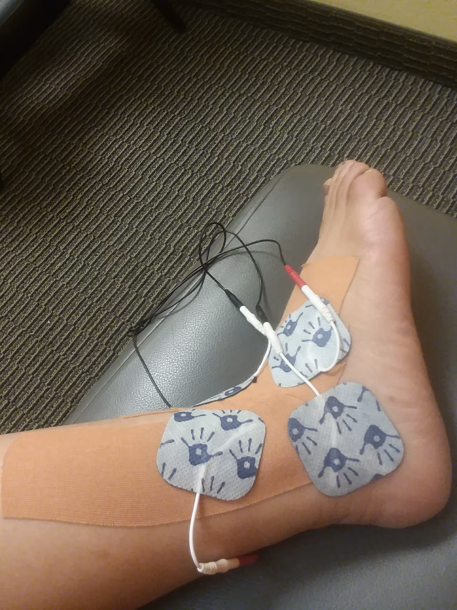 Lower leg with TENS pads and wires resting on a chair indoors.