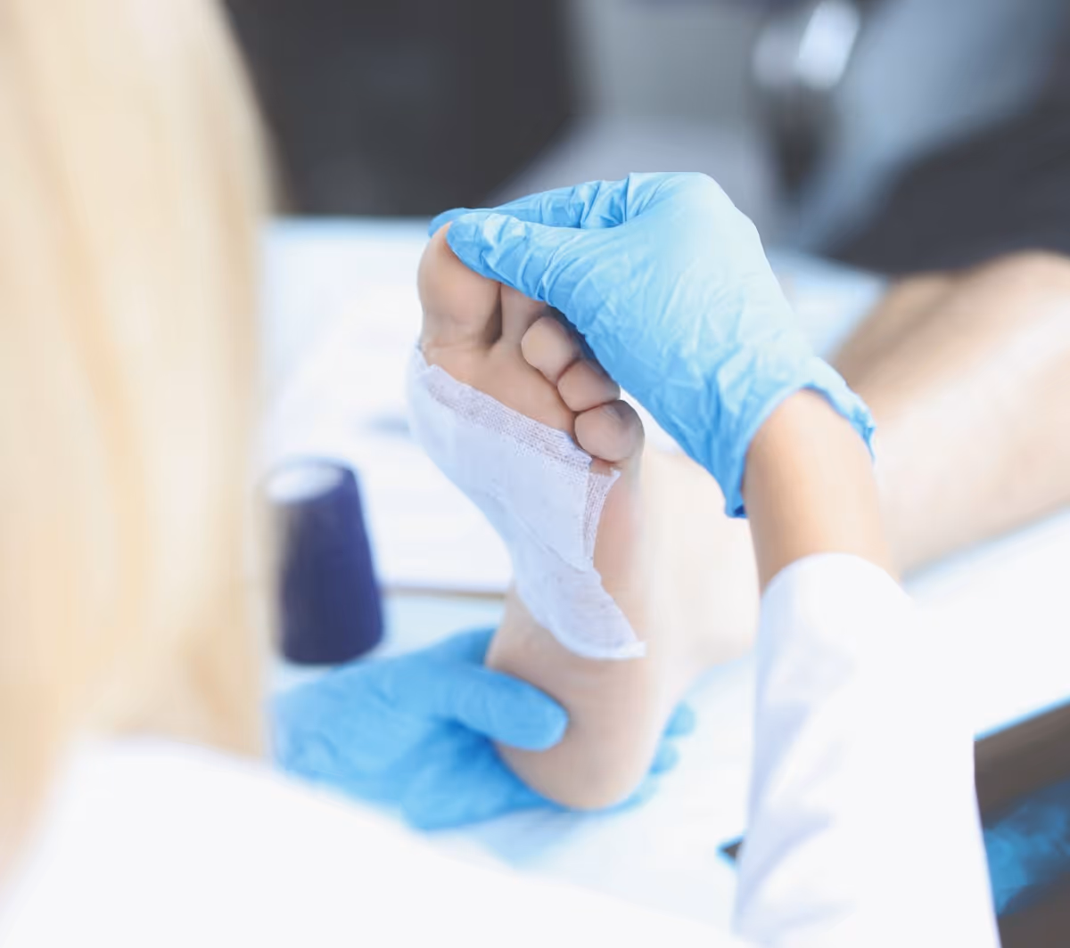 Blue-gloved clinician bandages a patient's foot in a wound care setting.