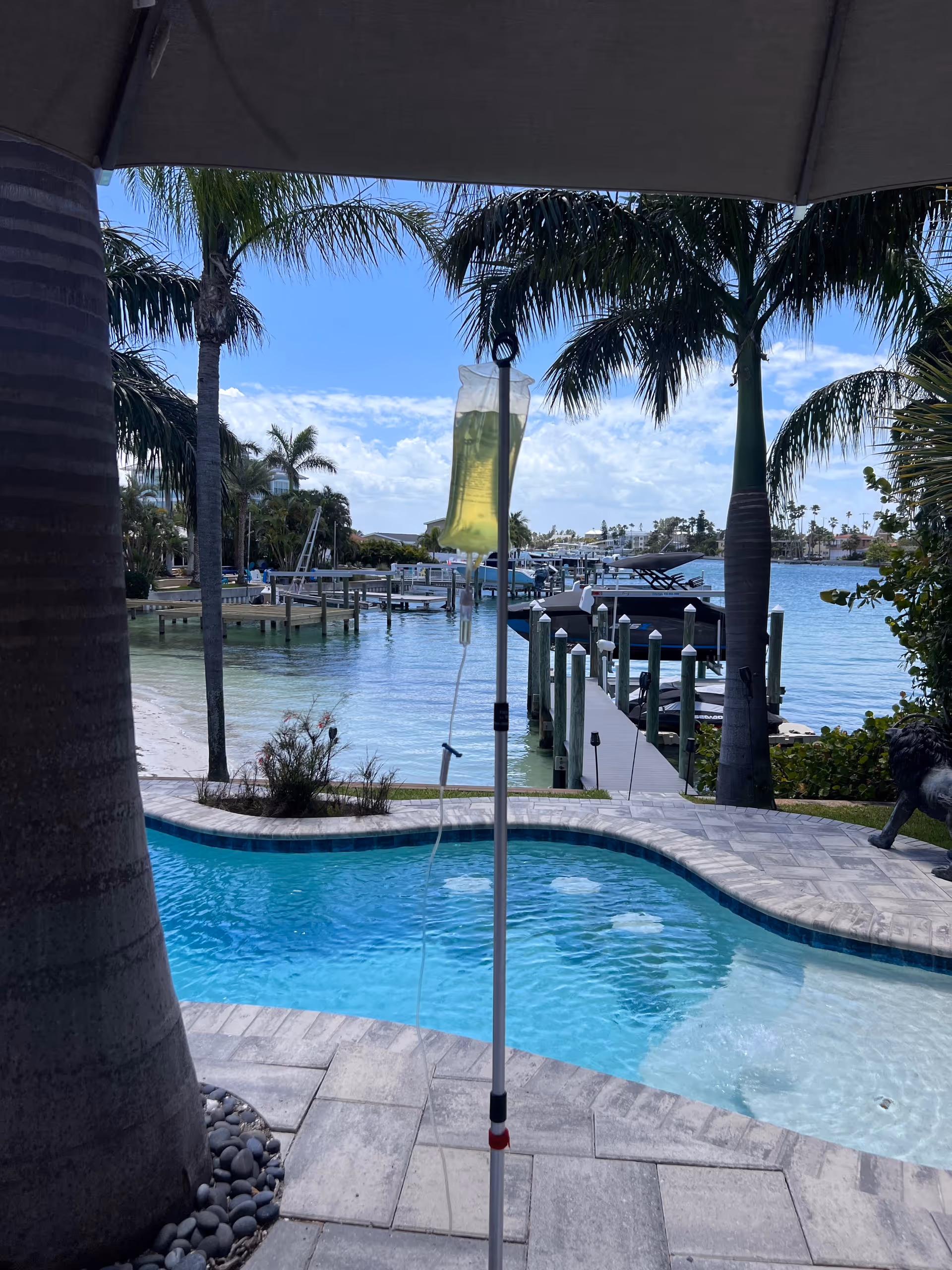 Outdoor pool deck with palm trees, docks, and an IV hydration drip stand beside the water.