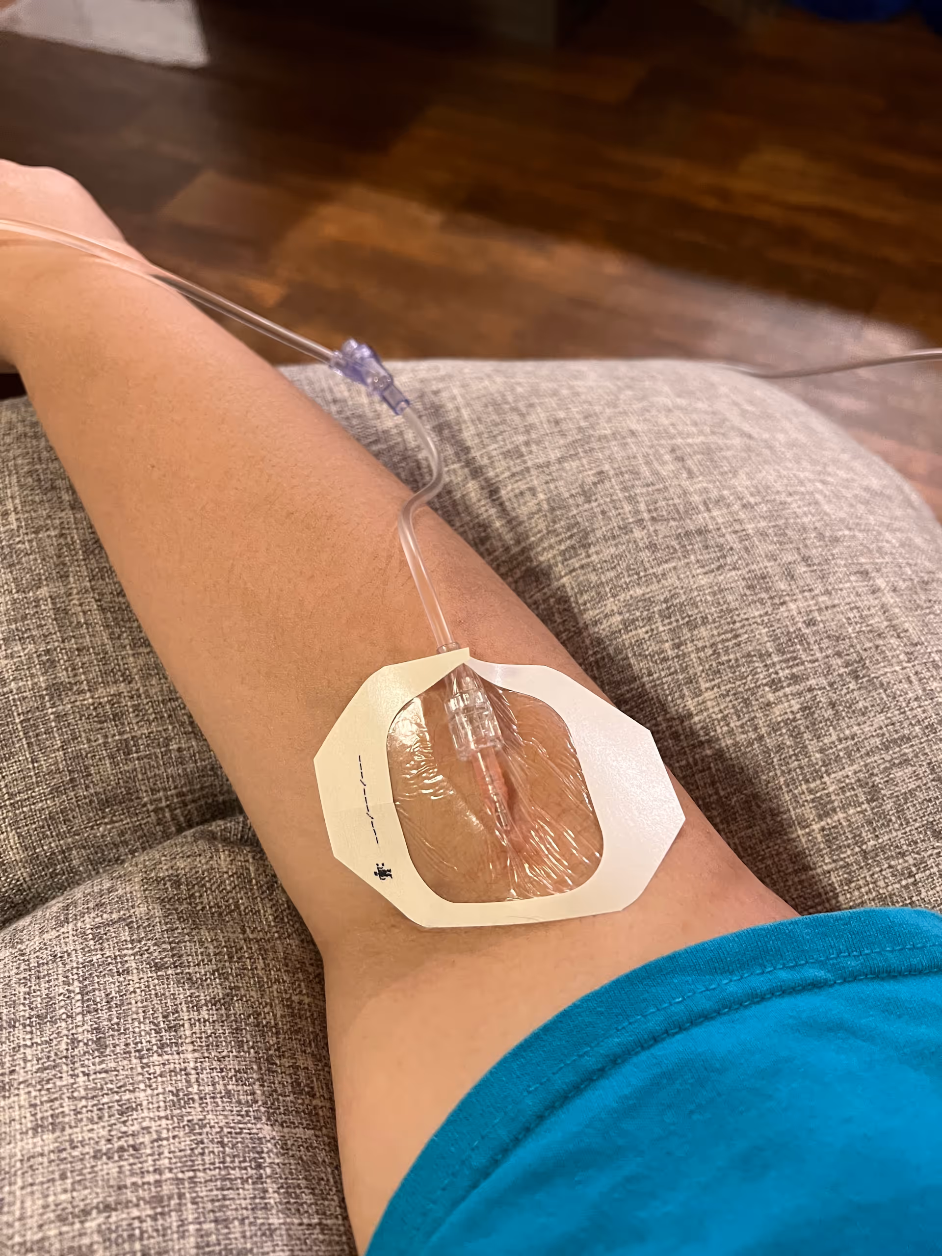 Close-up of a forearm with an IV catheter and adhesive dressing.