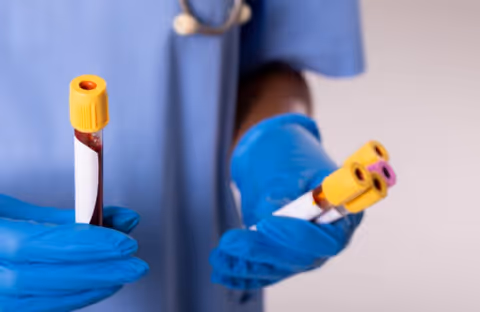 Close-up of gloved hands holding medical vials with blue scrubs in the background.