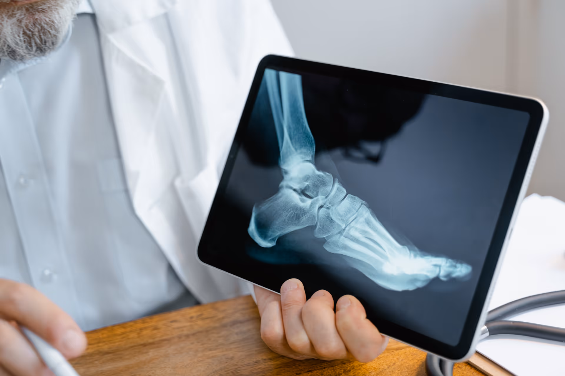 Medical professional holds tablet showing a foot and ankle X-ray in a clinical setting.