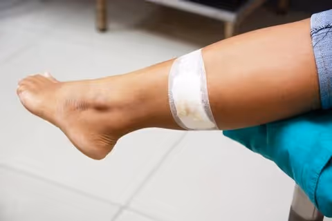 Close-up of a patient's leg with a bandage in a clinical setting.
