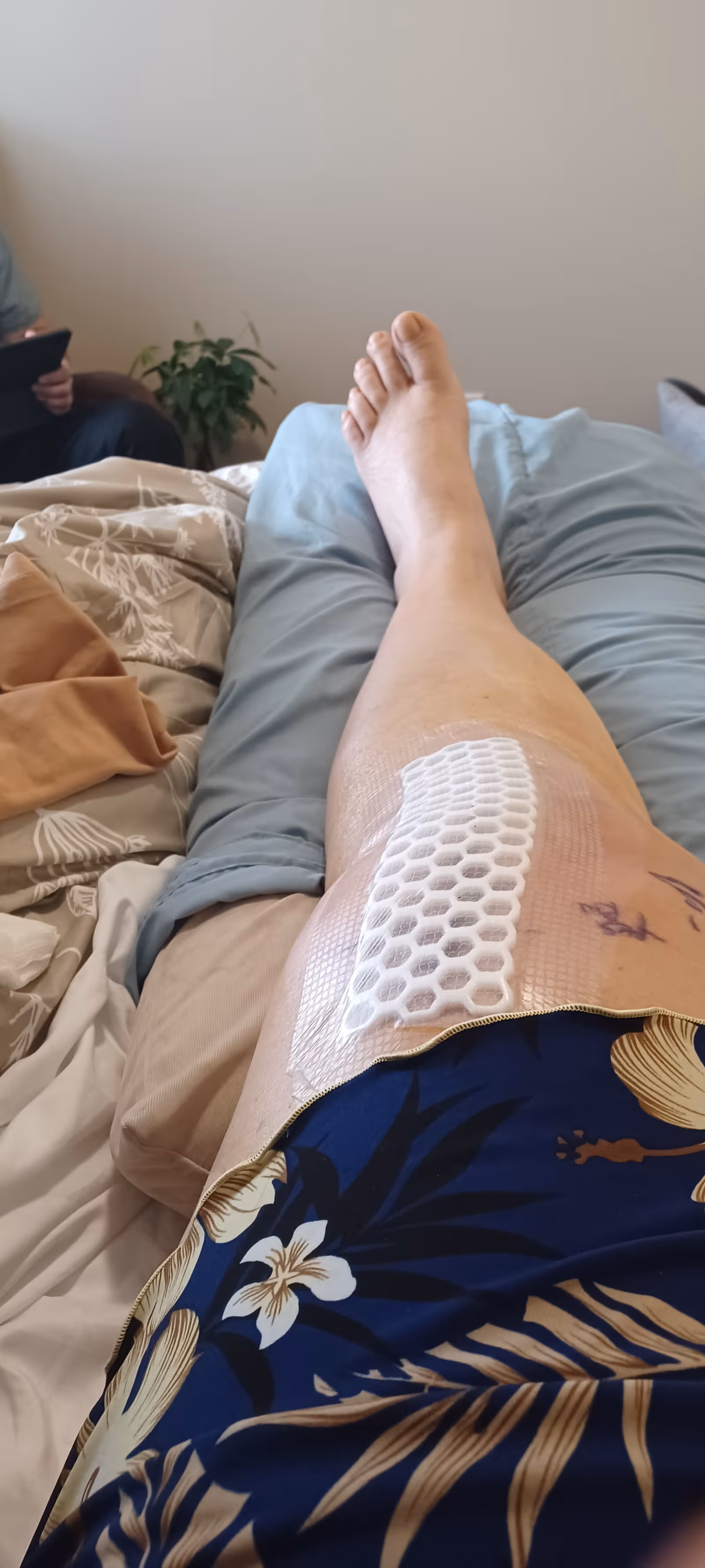 Resident's leg extended on bed with honeycomb medical wrap.