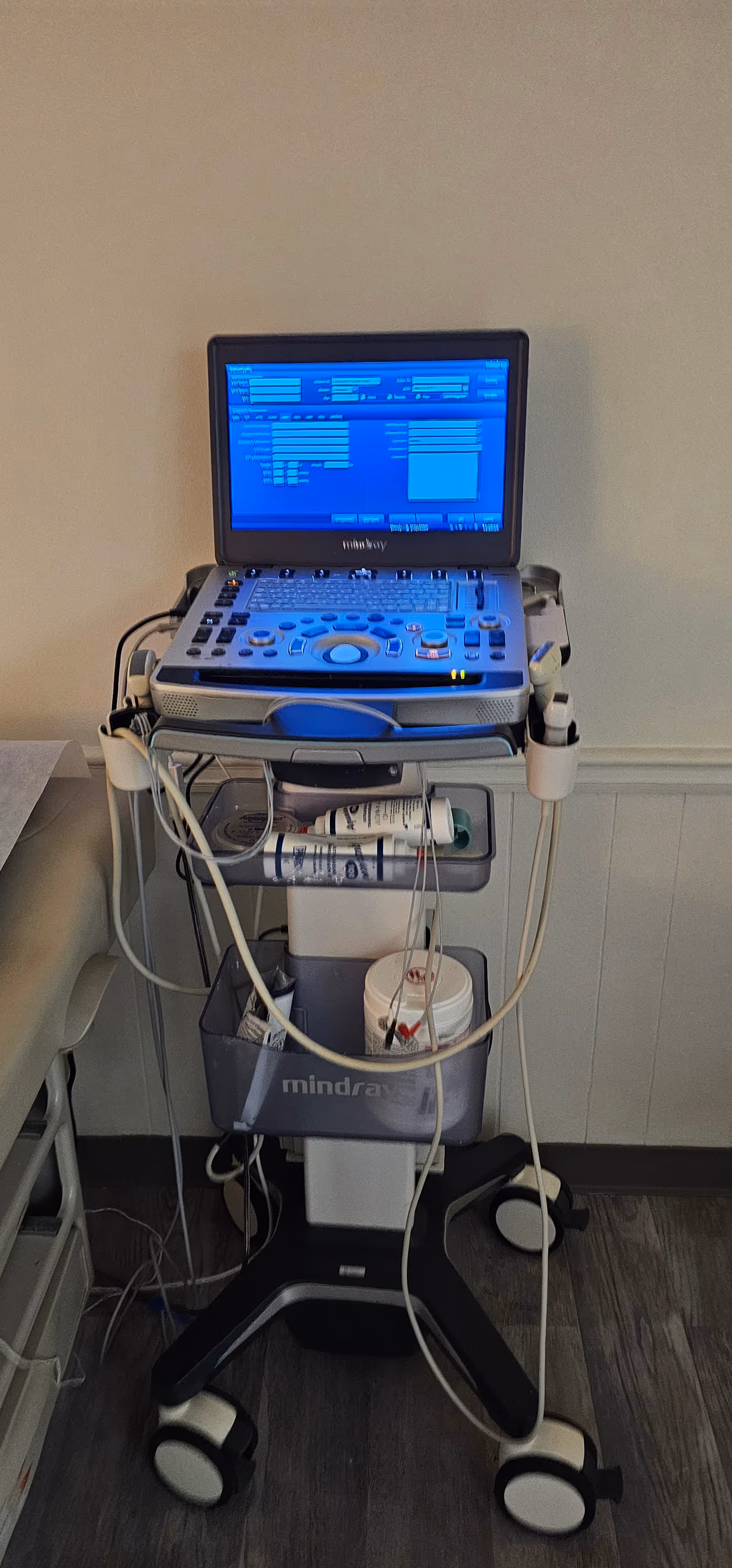 Ultrasound machine on a wheeled cart in a clinical room.