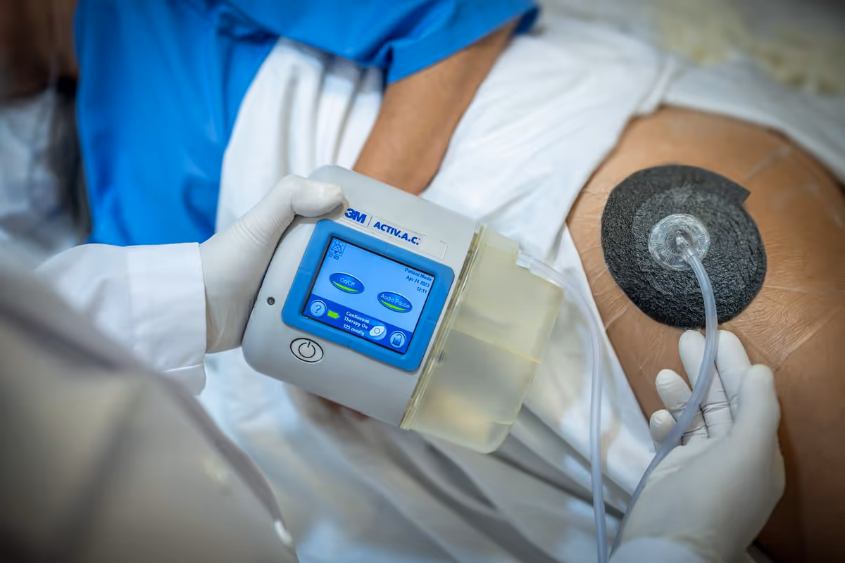 Gloved clinician attaches a medical device to a patient's leg in a clinical setting.