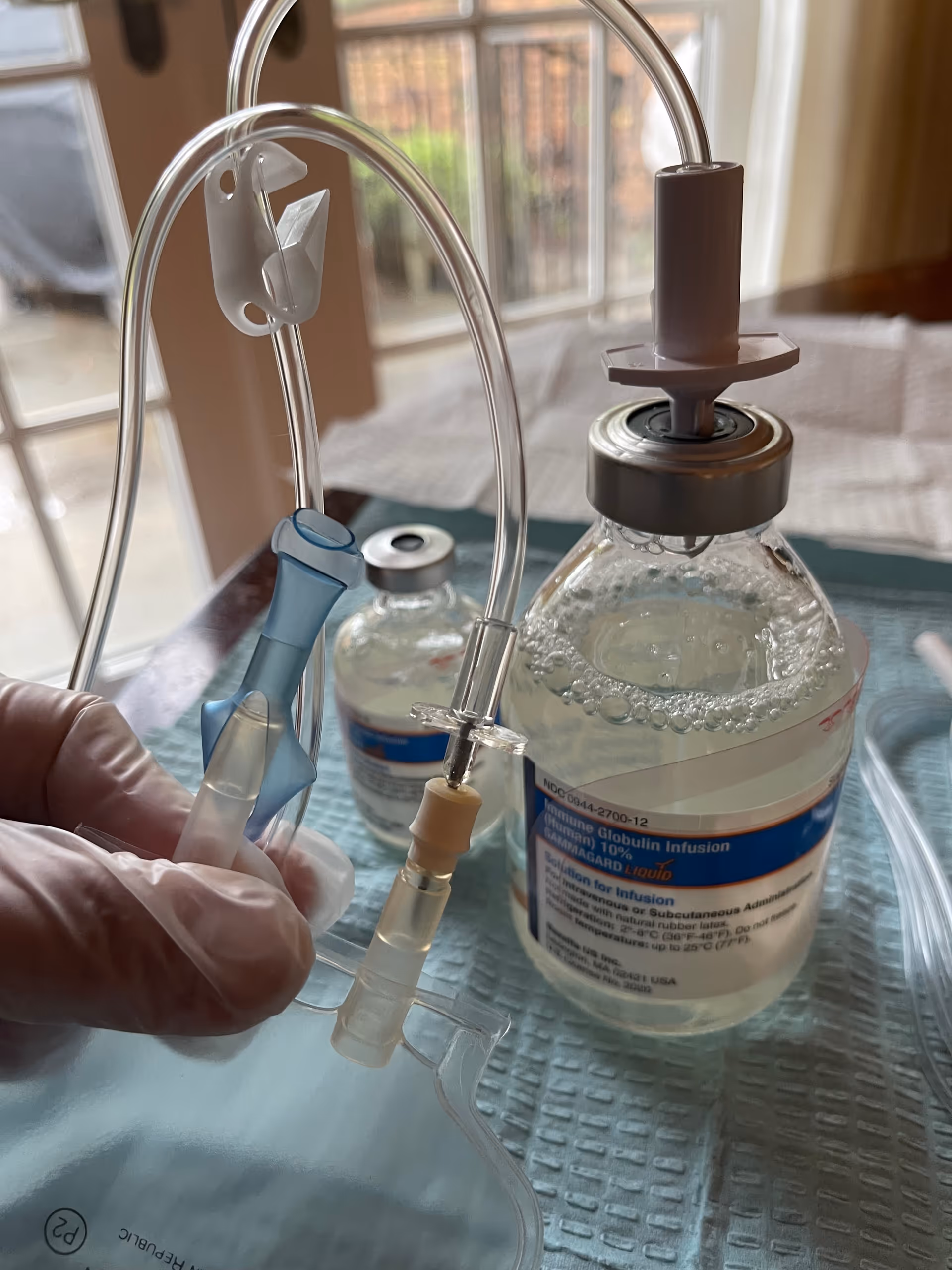 Close-up of IV infusion bag and tubing on a table.