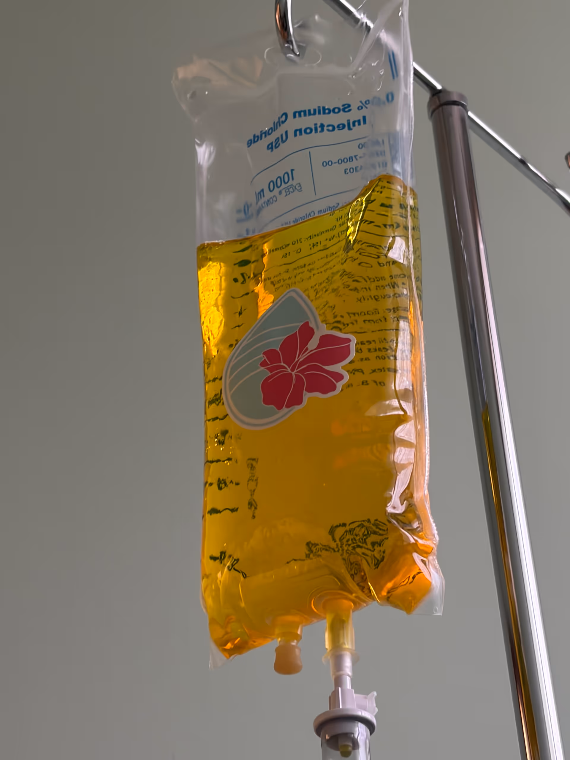 IV drip bag with yellow fluid hanging from a pole in a clinical interior.
