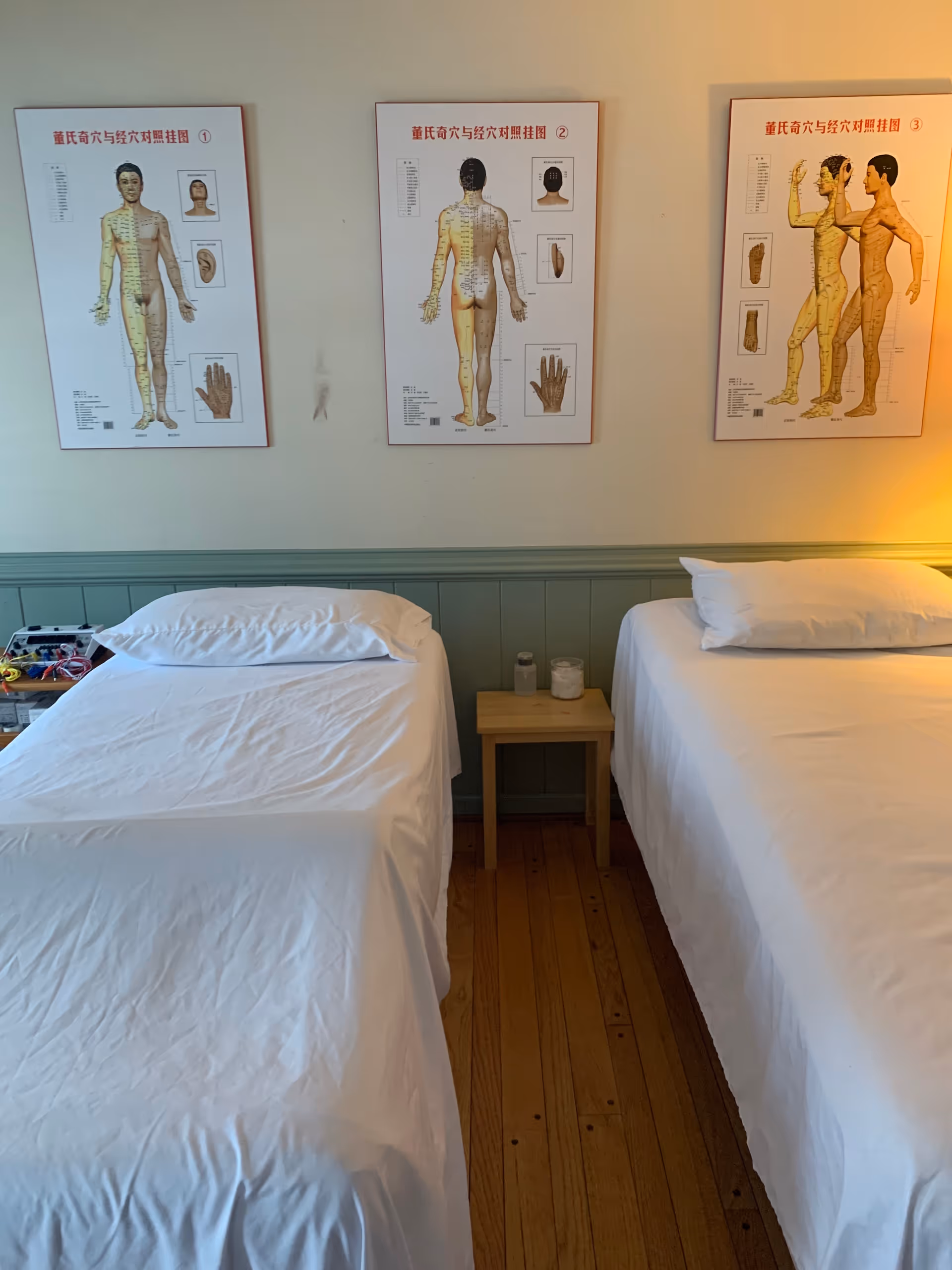 Two single beds with white linens flank a small nightstand beneath wall-mounted acupuncture diagrams.