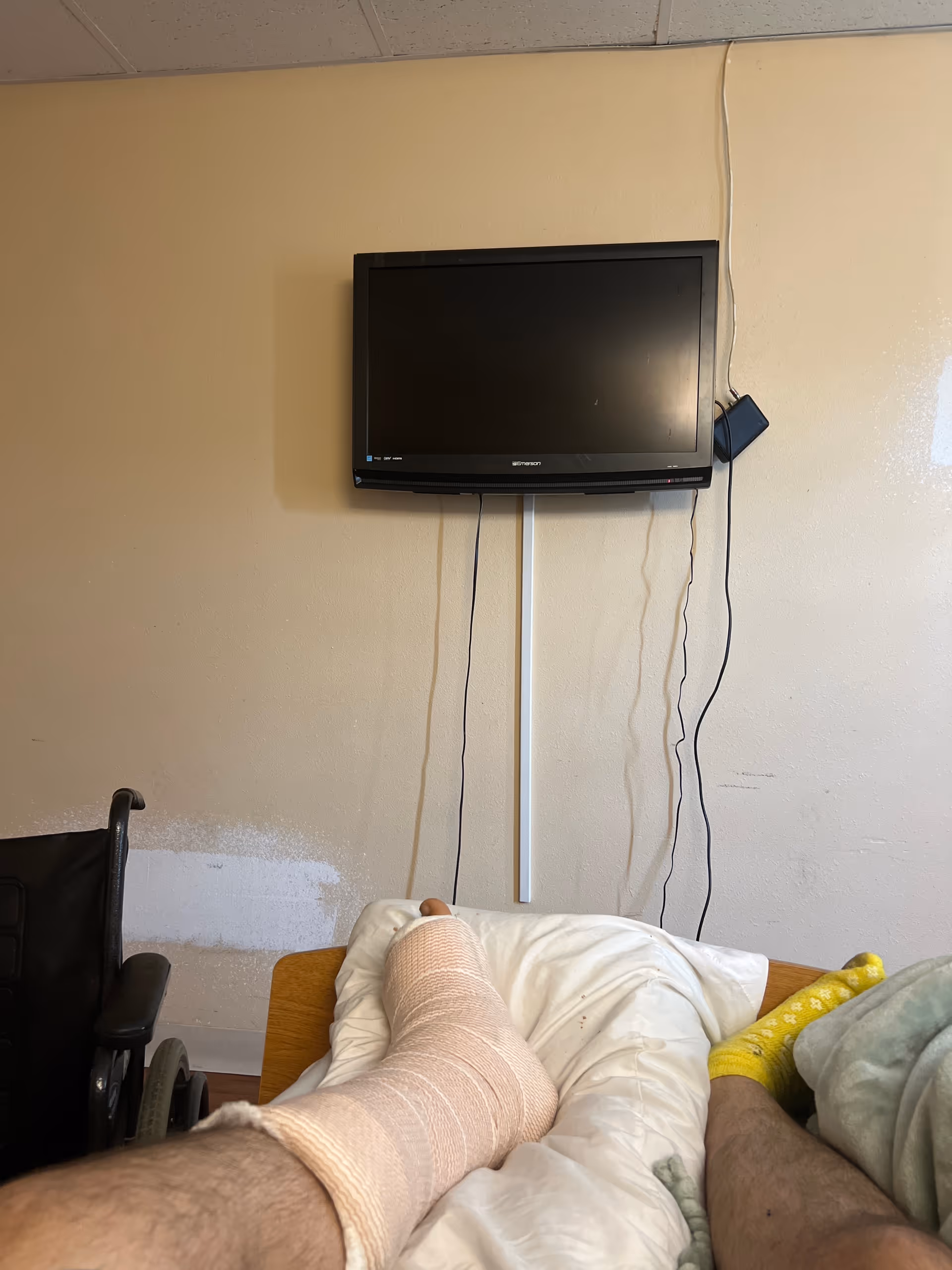 Resident's bandaged leg rests on a bed beneath a wall-mounted TV.