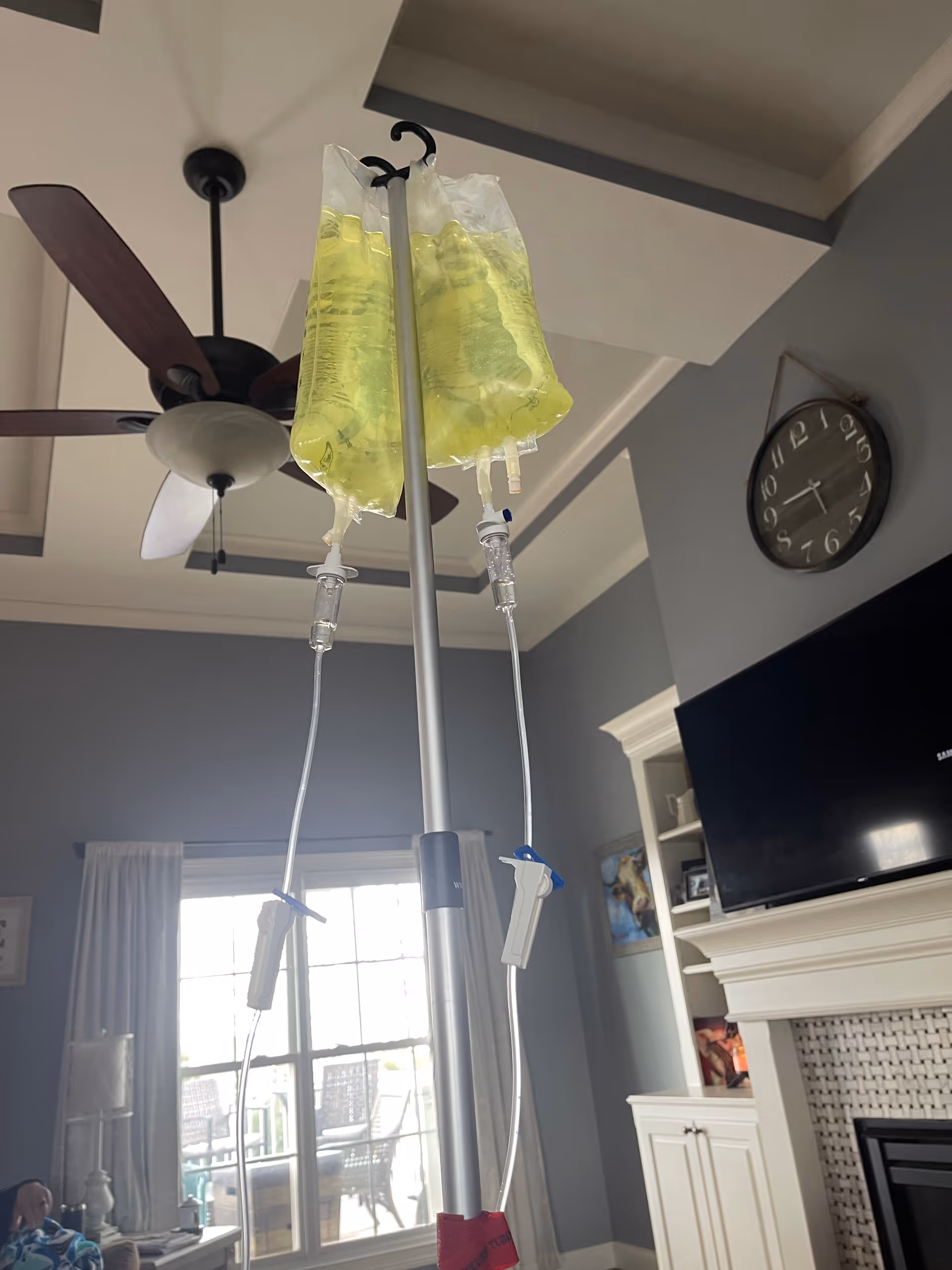 IV bags on a stand in a living room with ceiling fan and fireplace