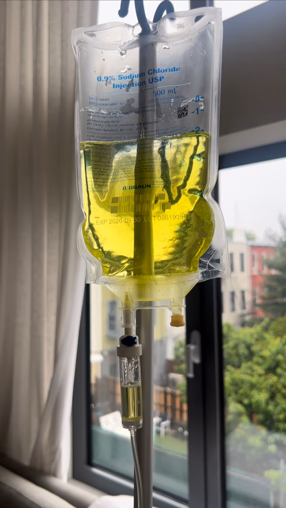 IV fluid bag with yellow solution suspended beside a window in a treatment room.