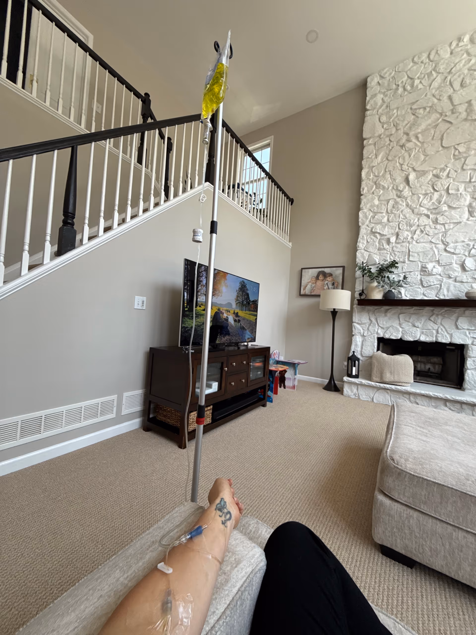 Living room with TV, stone fireplace, staircase, and IV pole near the couch.